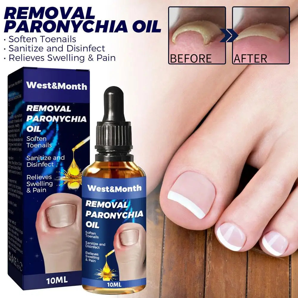 German Toenailcare Removal Paronychia Oil Ingrown Toenail Liquid Solution Repair Nail Renewal Best Nail Treatment K9w9