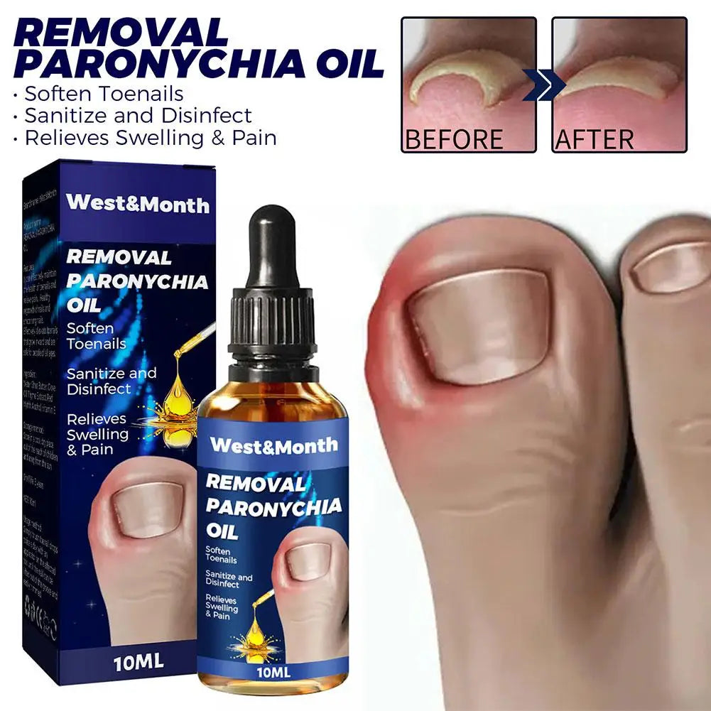 German Toenailcare Removal Paronychia Oil Ingrown Toenail Liquid Solution Repair Nail Renewal Best Nail Treatment K9w9