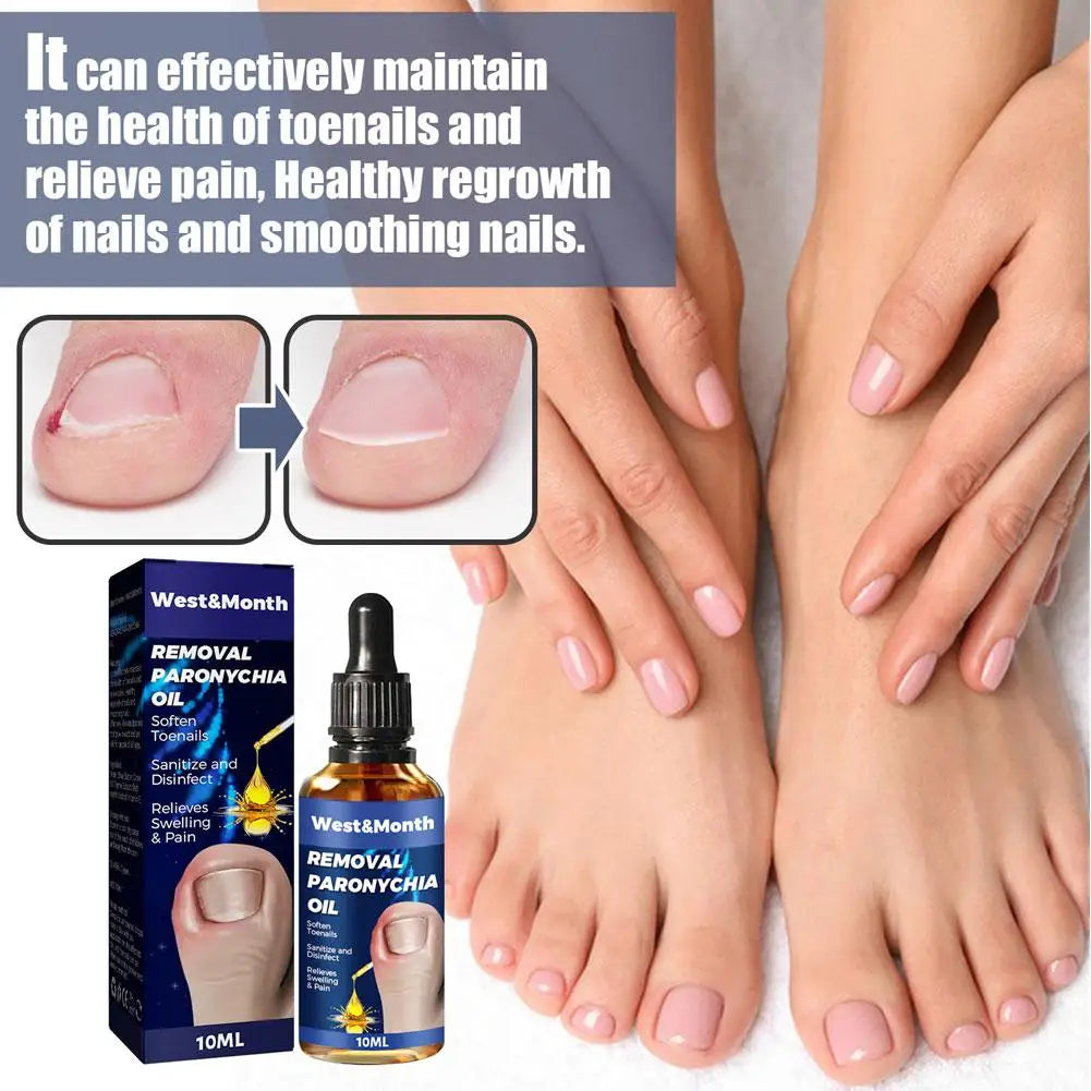 German Toenailcare Removal Paronychia Oil Ingrown Toenail Liquid Solution Repair Nail Renewal Best Nail Treatment K9w9